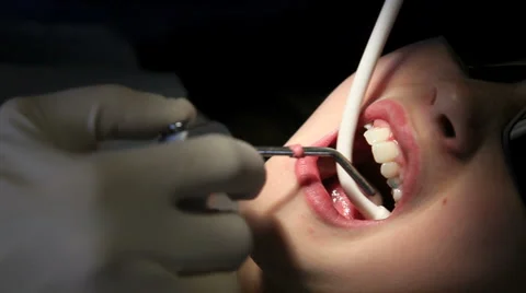 Dental3 Stock Footage 1099004