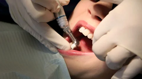 Dental5 Stock Footage 1099022