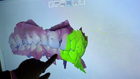 Dentist analyzing 3d scan of teeth on computer Stock Footage 306061157