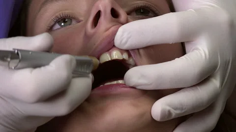 Dentist and anesthesia Video stock 53022770