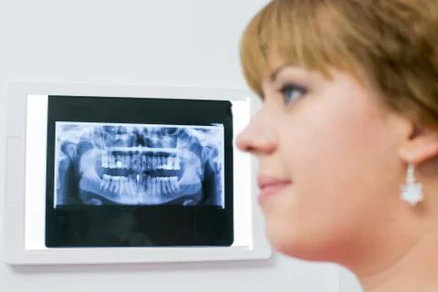 Dentist and x-rays Foto stock