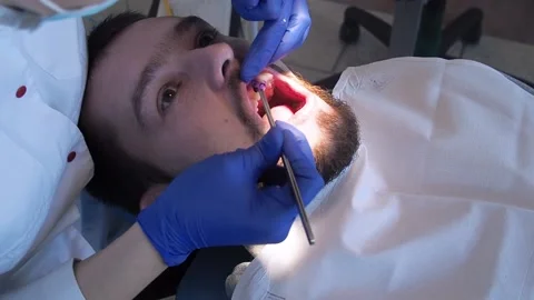 Dentist is applying blue gel on man teeth to find dental tartar and caries Stock Footage 163845332