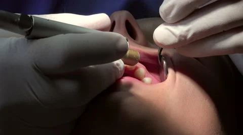 Dentist begin anesthesia before operate Stock Footage 53024181