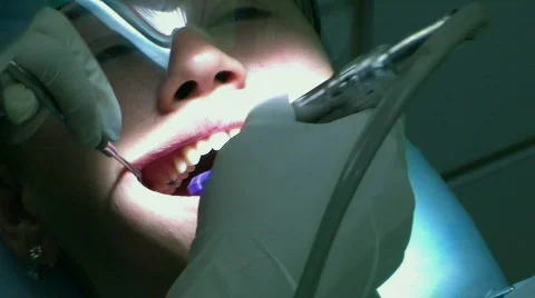 Dentist Buffer Teeth 動画素材 143974