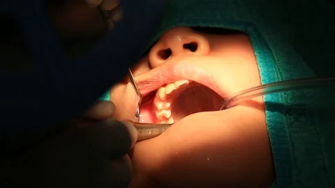 Dentist Checking And Treating Tooth Decay (handheld shot) Stock Footage 75990963