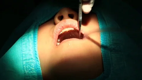 Dentist Checking And Treating Tooth Decay (sound) Vidéo 75991408
