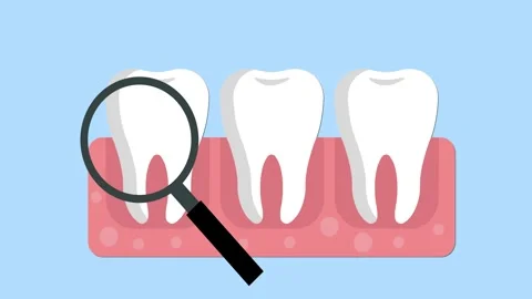 Dentist checking germs in teeth poor oral hygiene animation Stock Footage 241835716