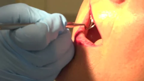 Dentist checking teeth Stock Footage 220904689