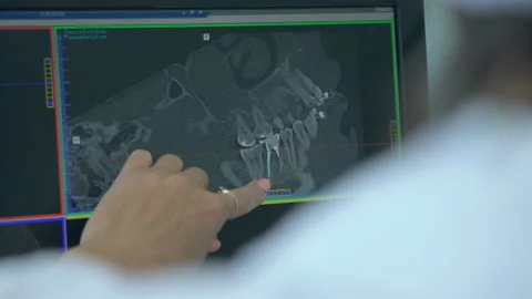 Dentist Checking X Ray Of Patient Teeth On Digital Screen Stock Footage 94383335