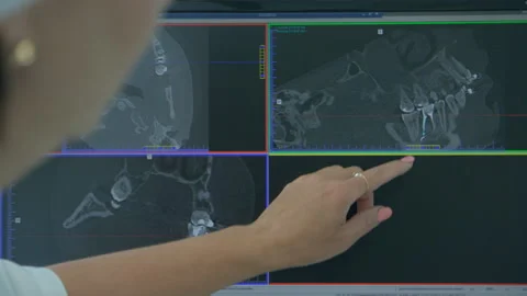 Dentist Checking X Ray Of Patient Teeth On Digital Screen Stock Footage 94383926