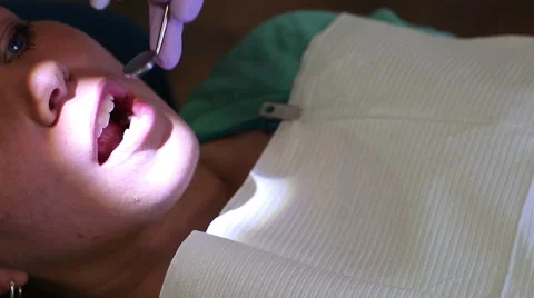 Dentist Cleaning Teeth from Above Stock Footage 57754350
