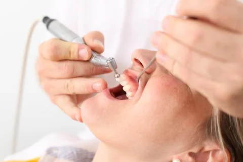 Dentist cleaning teeth Stock Photos