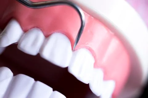 Dentist cleaning teeth Stock Photos