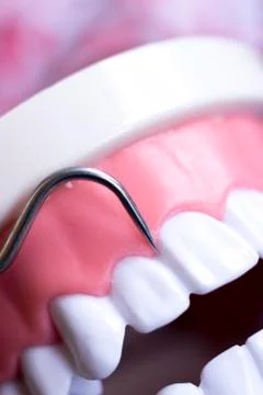 Dentist cleaning teeth Stock-Fotos