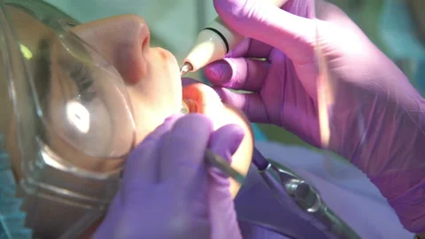 Dentist Cleans Teeth of Patient Stock Footage 85908281