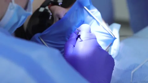 Dentist close-up tool treating teeth Professional doctor stomatologist Stock Footage 153939085