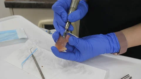 Dentist correcting denture by grinding close up Stock-Footage 194954367