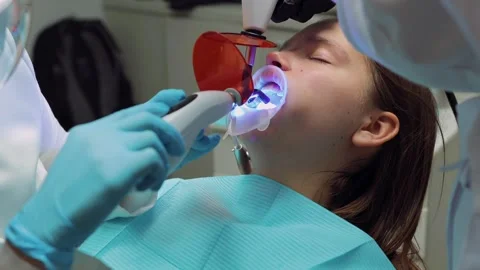 Dentist curing adhesive with UV light during aligner bonding procedure on t.. Stock Footage 305500460
