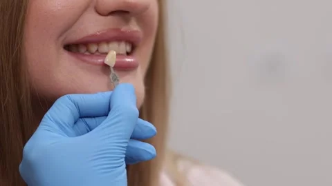 A dentist demonstrates the process of installing veneers to improve a clients Stock Footage 318630503