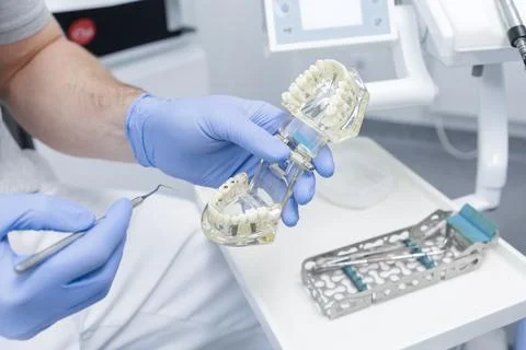 Dentist demonstrating jaw model with implants during dental consultation in.. Stock Photos