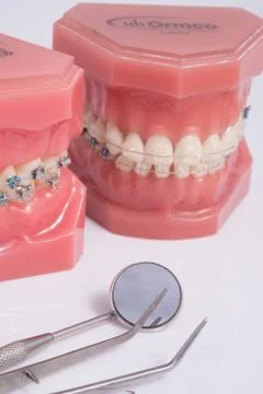 Dentist demonstration teeth model of varities of orthodontic bracket . Stock Photos