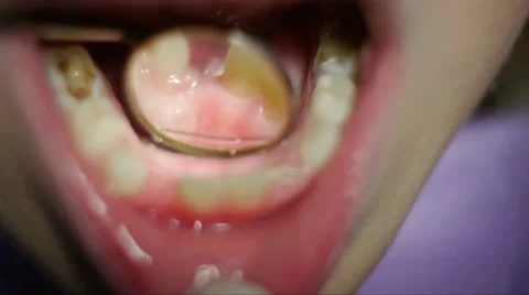 Dentist diagnoses Stock Footage 66692743