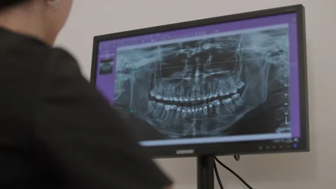 Dentist doctor examines a panoramic x-ray of the jaw on a computer screen. Stock Footage 250352774
