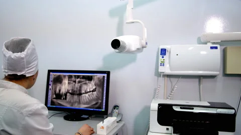 Dentist examines X-ray panoramic patient jaw picture Stock Footage 239434418