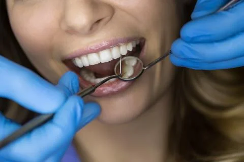 Dentist examining a patient's teeth in the dentist Foto stock