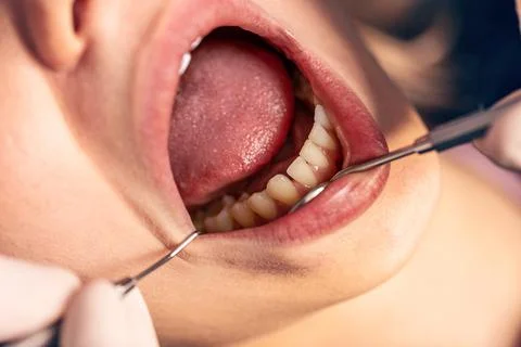 Dentist examining teeth Stock Photos