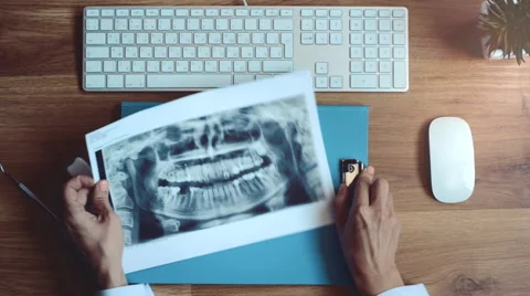 Dentist examining teeth x-ray Stock Footage 65379084