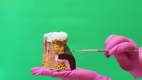 Dentist Explaining Molar Tooth and Jawbone Anatomy on Cross Section Model Stock Footage 337106635