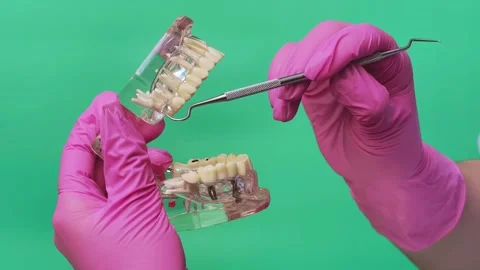 Dentist Explaining Tooth Cavities and Dental Implants on Transparent Jaw Model Stock Footage 337106291