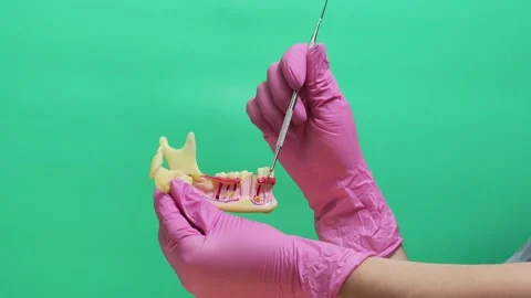 Dentist Explaining Tooth Root and Gum Anatomy on Jaw Model Against Green Screen Stock Footage 337106566