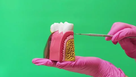 Dentist Explaining Tooth Root, Gum and Jawbone Anatomy on Dental Model Stock Footage 337106630