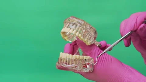 Dentist Explaining Tooth Roots and Nerves on Transparent Jaw Model Stock Footage 337106275
