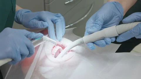 Dentist flushing blue plaque indicator with water spray and suction tool 스톡 동영상 332299878