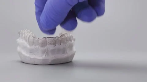 Dentist hand in blue glove placing clear orthodontic aligner onto lower Stock Footage 340052385