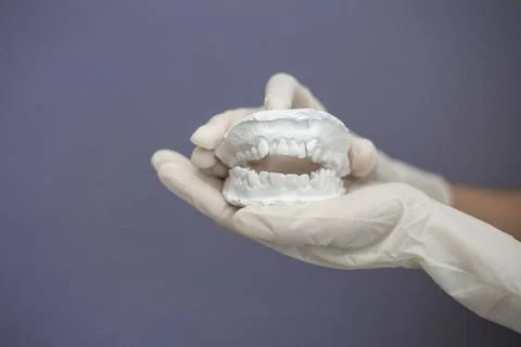 Dentist hand with plaster model Foto stock