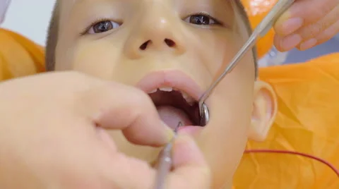 Dentist hands gently removes a baby tooth in a child Stock Footage