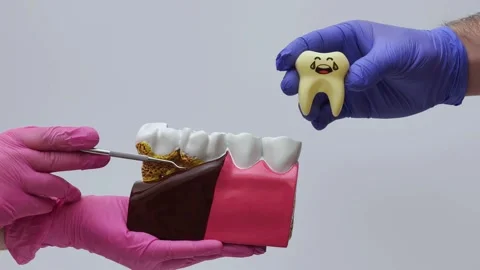 Dentist hands holding a dental model with periodontitis Stock-Footage 333550331