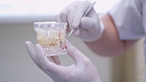 Dentist holding jaw model and pointing to teeth with medical probe. Stock Footage 337469385