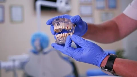 Dentist holding transparent jaw model demonstrating dental implant placemen.. Stock Footage 337597879