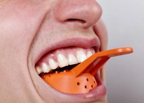 Dentist inserts blade Stock Photos