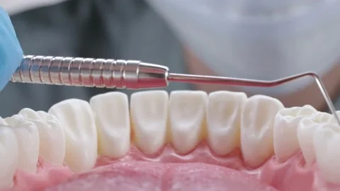 Dentist inspecting teeth with probe Stock Footage 139686302
