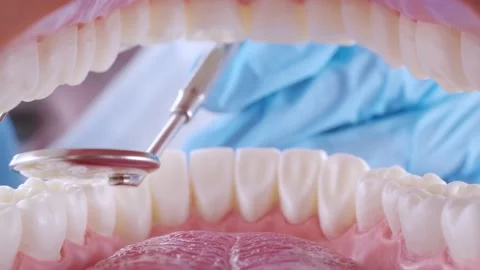 Dentist inspects patient's teeth with probe and mirror Stock Footage 139685207