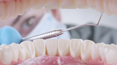 Dentist inspects patient's teeth with probe and mirror Stock Footage 139685607
