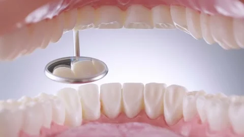 Dentist inspects teeth with mirror Stock Footage 139637141