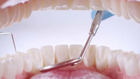 Dentist inspects teeth with probe and mirror Stock Footage 139636816