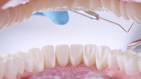 Dentist inspects teeth with probe and mirror Stock Footage 139636900